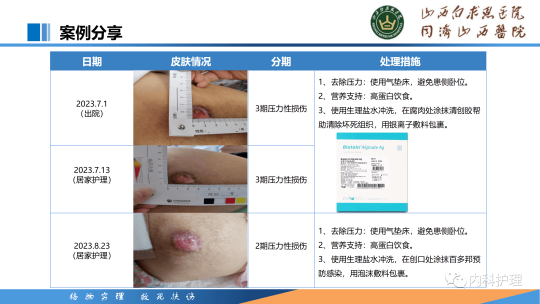 最新压力性损伤的分期：压力性损伤分期新进展